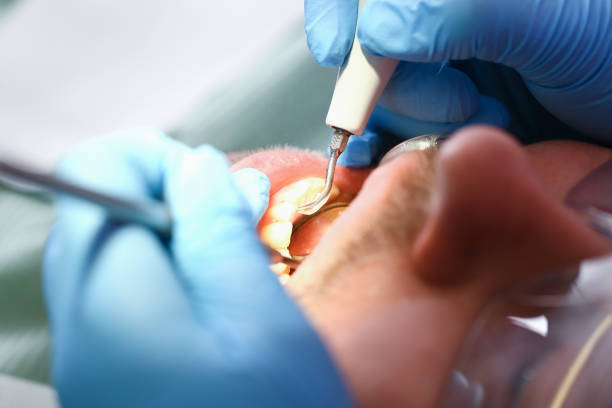 Best Weekend Emergency Dentist in East Ithaca, NY