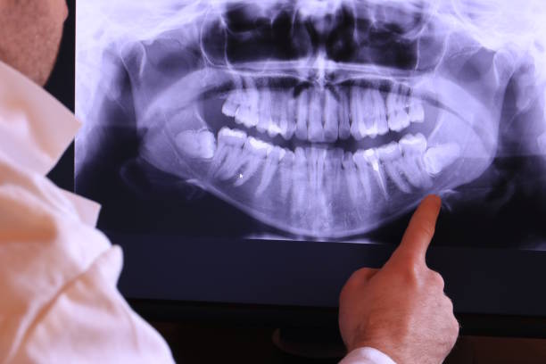 Best Emergency Gum Treatment in East Ithaca, NY